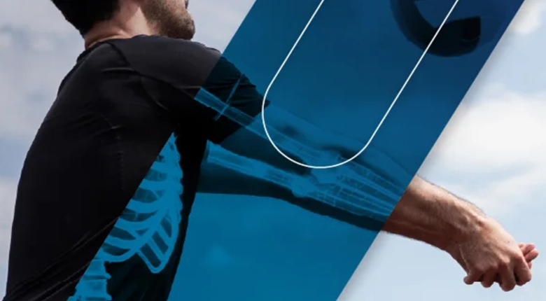 Curso Avanzado en TRAUMATOLOGÍA DEL DEPORTE (2026)